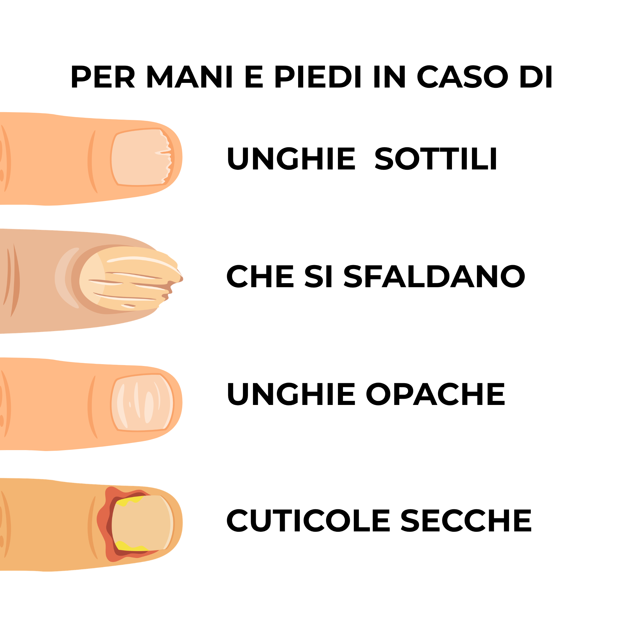 Elisir N. 5 Rinforzante Unghie 15 ml – Trattamento d'urto 100% attivo per unghie fragili e da risanare